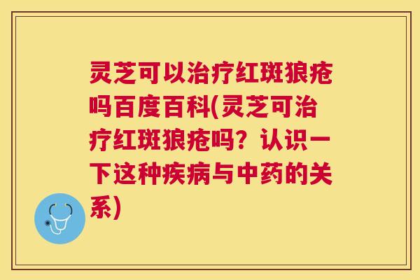 灵芝可以红斑狼疮吗百度百科(灵芝可红斑狼疮吗?认识一下这种与的关系) 灵芝可以红斑狼疮吗百度百科(灵芝可红斑狼疮吗?认识一下这种与的关系)